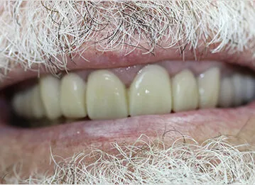 Case 2 After
