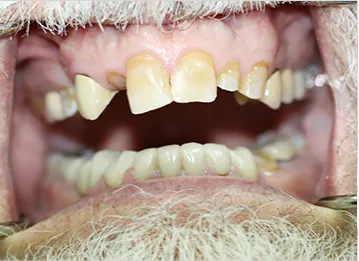 Case 2 Before
