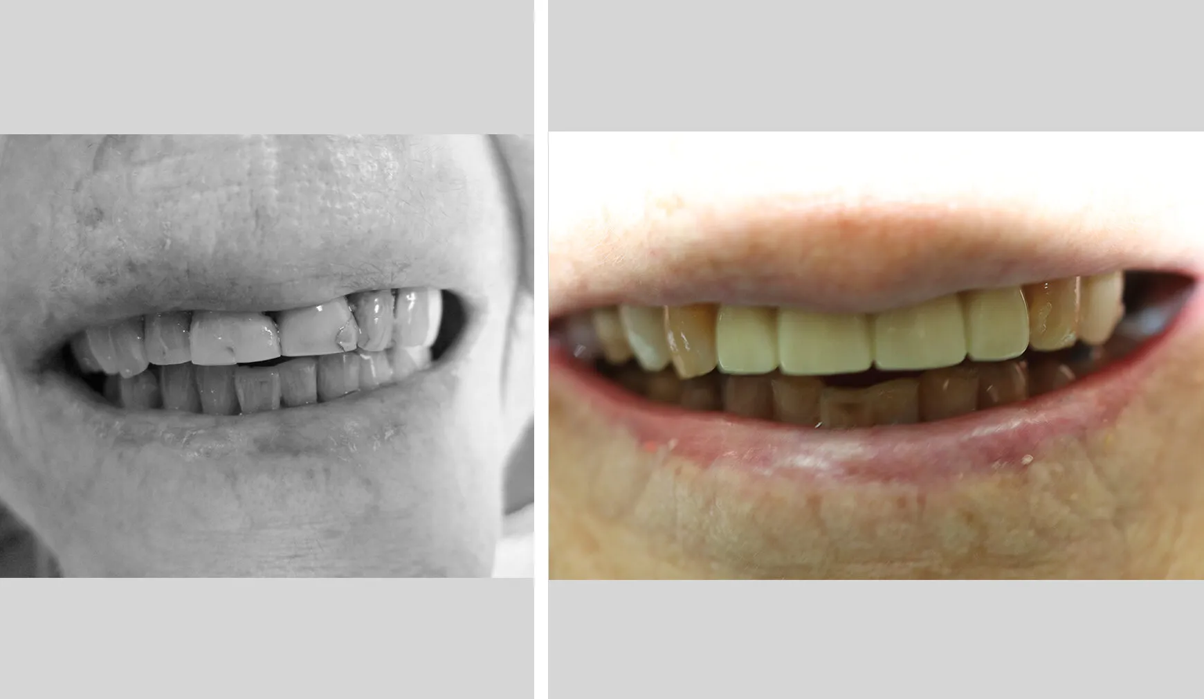 Case 2: before and after
