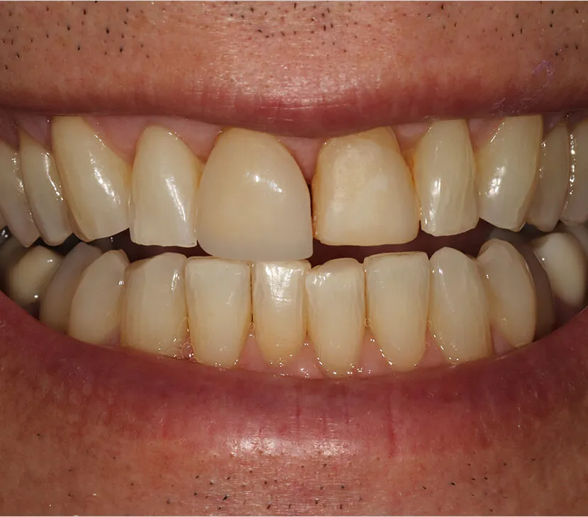 Case 1 Before