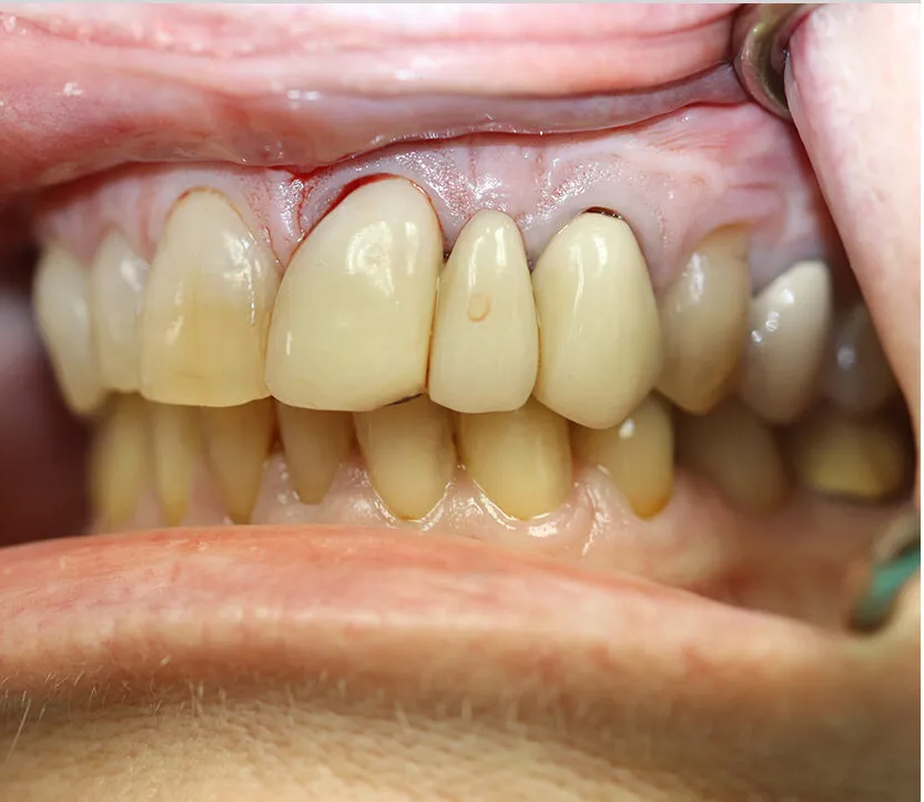 Case 4 Before